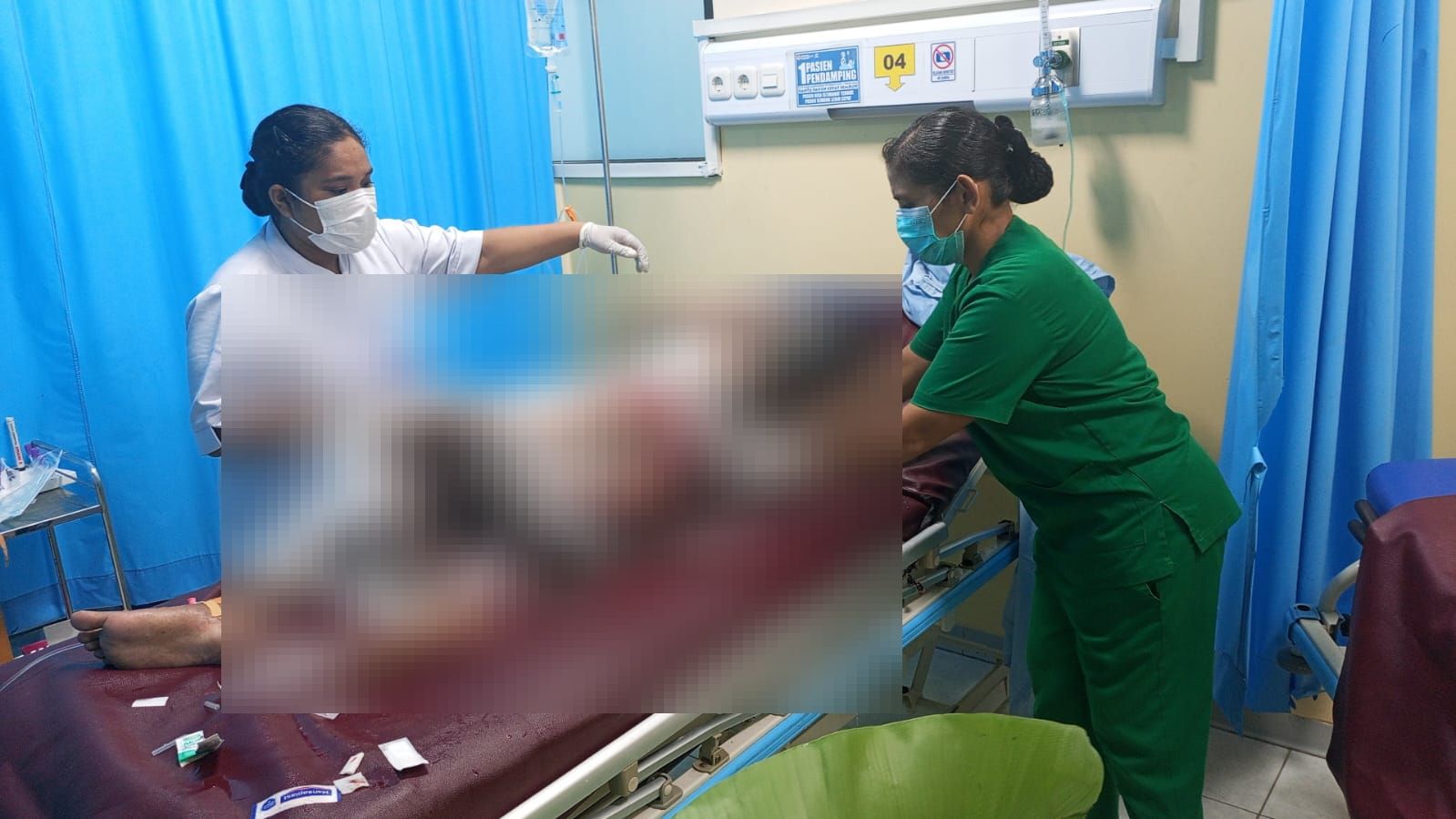 *Diduga Bakar Anak di Sentani Timur, Polisi Dalami Kasus Setelah Korban Meninggal Dunia*